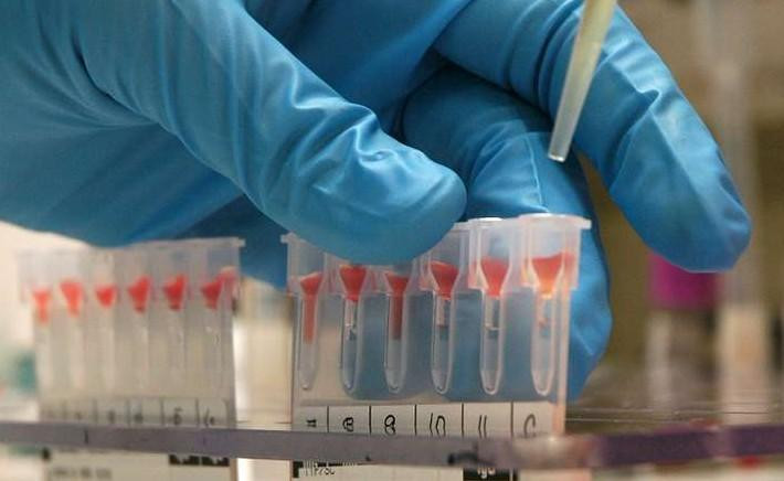 Доктора рассказали о препарате, после приема которого умерла московская студентка