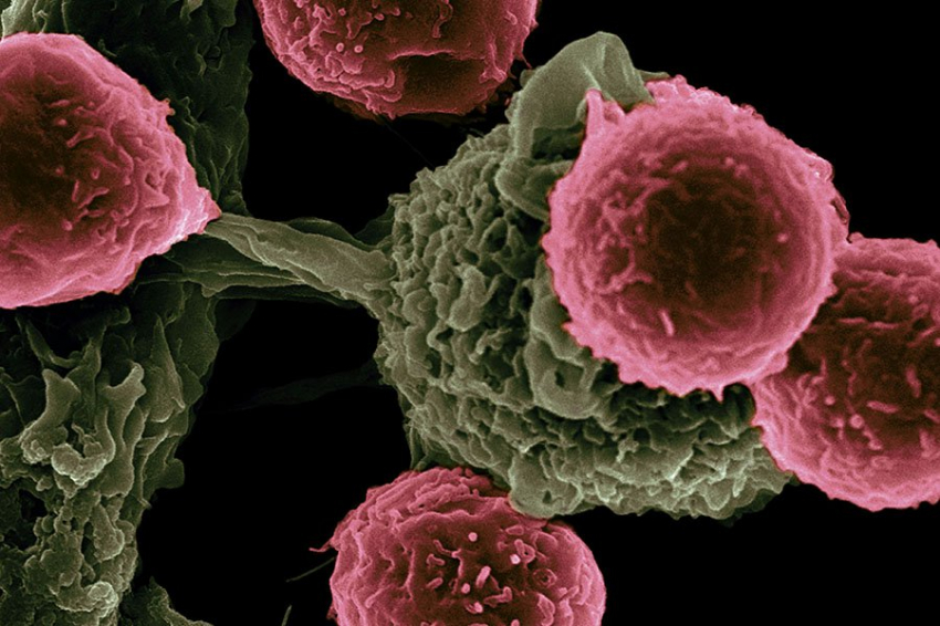 Cancer Epidemiology: риск развития рака увеличивается у родственников больных лейкемией