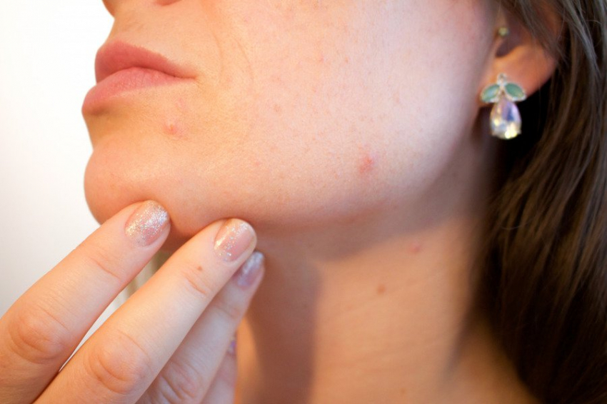 В Швеции предложен эффективный способ диагностики рака кожи