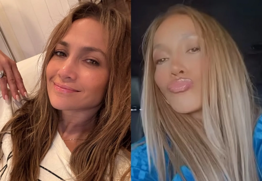 "Похоже на третью или четвёртую пластику носа". Поклонники заподозрили, что Дженнифер Лопес сделала пластическую операцию