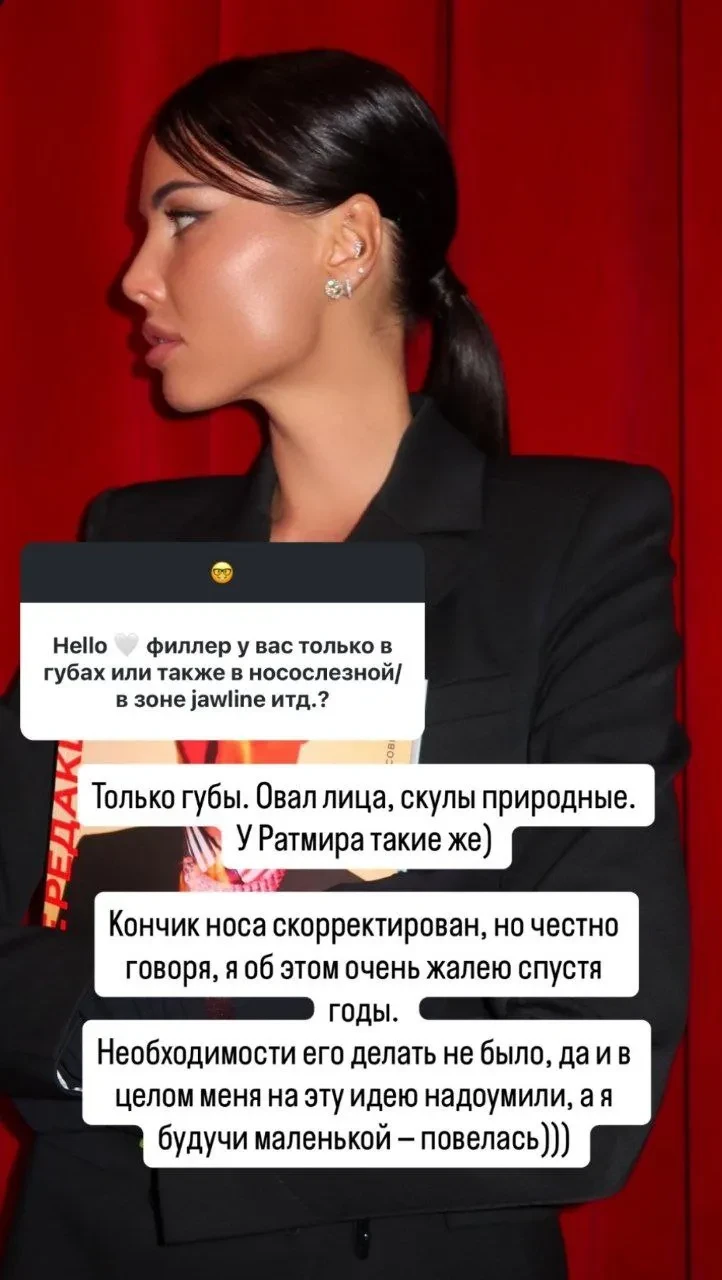 "Скулы природные". Анастасия Решетова рассказала о своих пластических операциях, на которые её "надоумили"